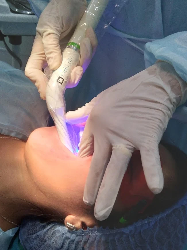 Blanqueamiento dental