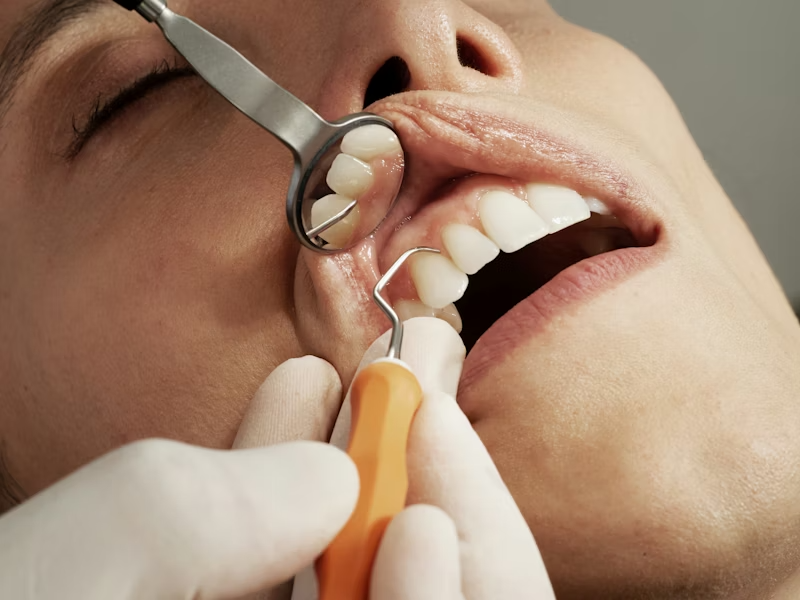 Cirugia-estetica-oral