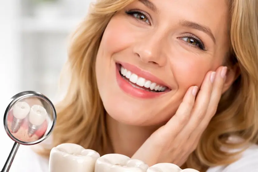 Implantes-dentales-ibague