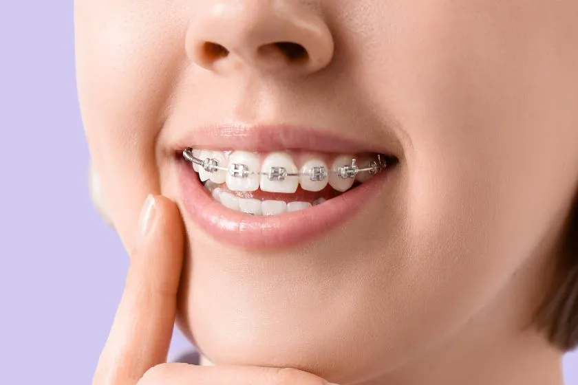ortodoncia-con-brackets